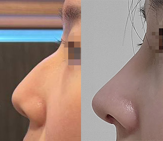 원하던코로 딱 해주셨어욤^^