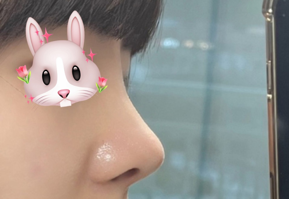 첫코 너무 잘된거같아요:)