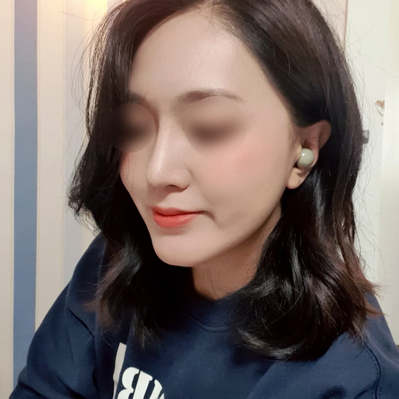 수술이 너무 성공적이라 만족스러움 ㅎㅎ