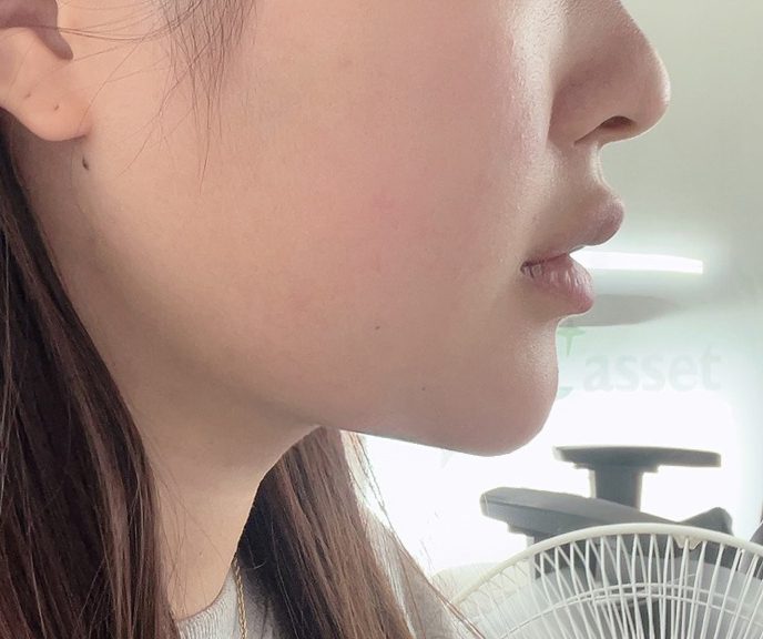 이중턱 뿌시고 싶다면 바이브추천ㅋㅋ