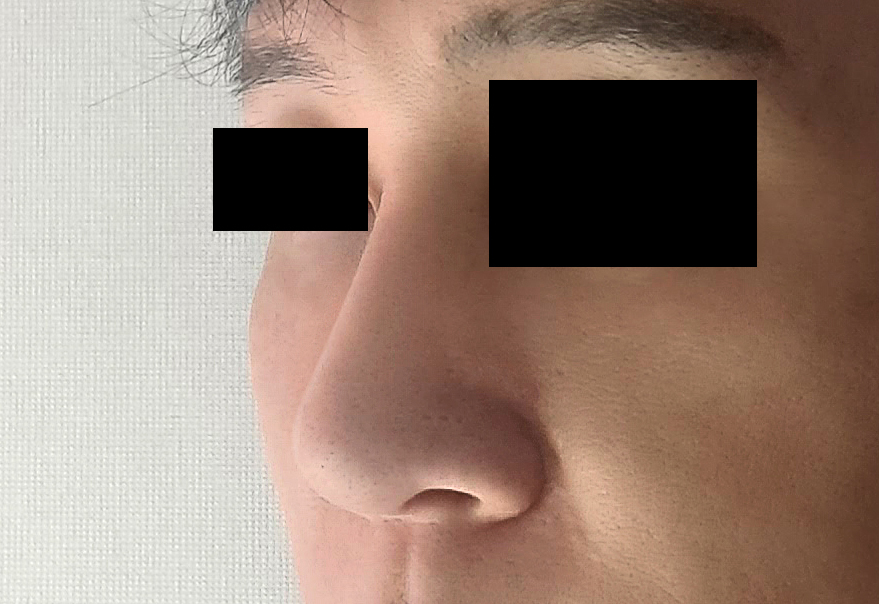 코3개월차인데 자연스럽네요