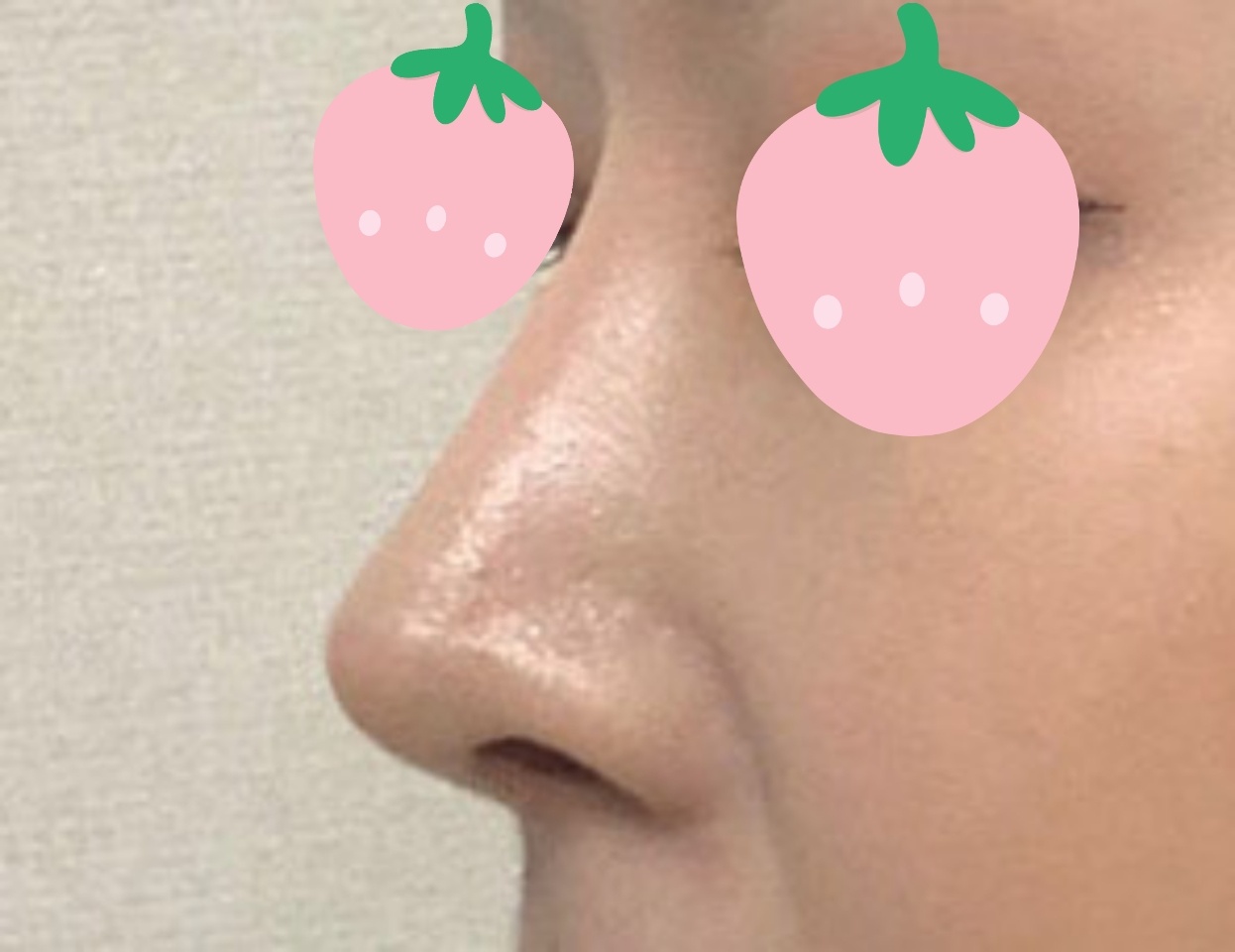 코라인 너무 예뻐요:)