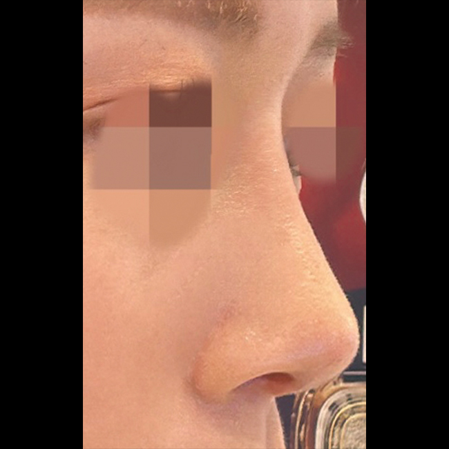 코하니까 주변에서 이쁘다고 해요^^