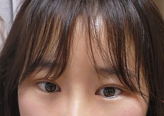 수술하고 나서 완전히 다른 사람으로 변신했어요