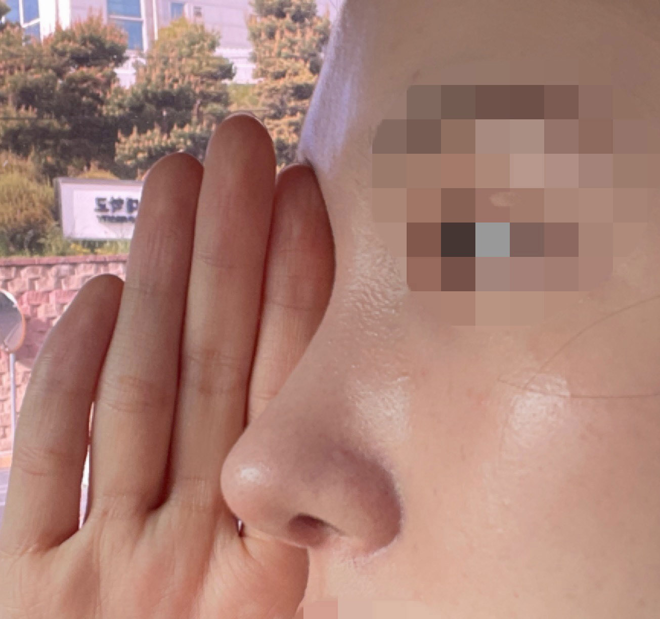 4개월전 바이브에서 코성형받았습니다!