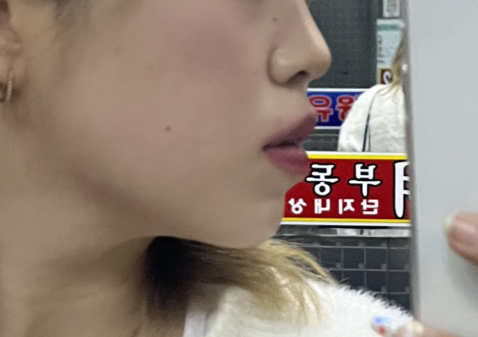 지흡했을 뿐인데 살 많이 빠졌다고 들어요!