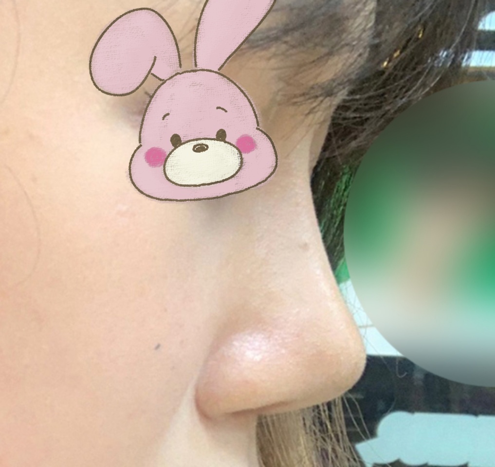 친구 한거 보고 바이브에서 코했어요!