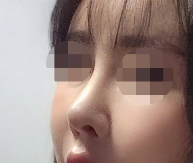 눈, 코 대만족중^^ㅎ