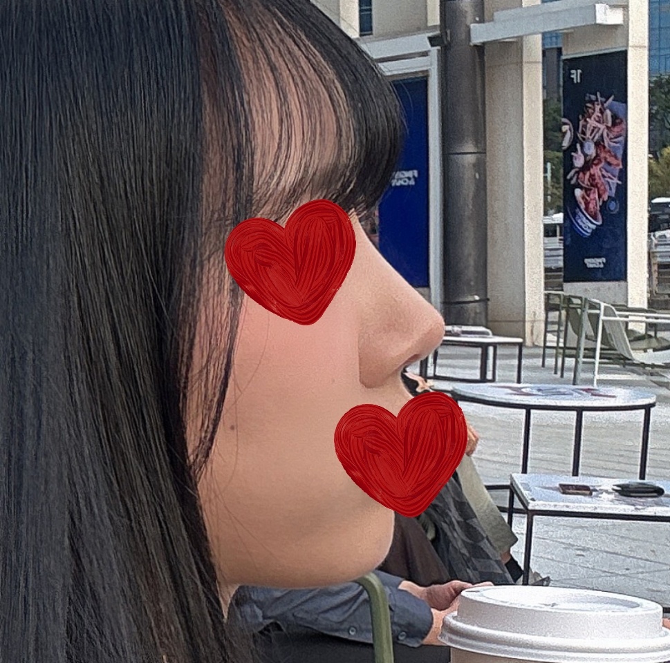 코수술3개월차! 얄쌍하구 오똑><