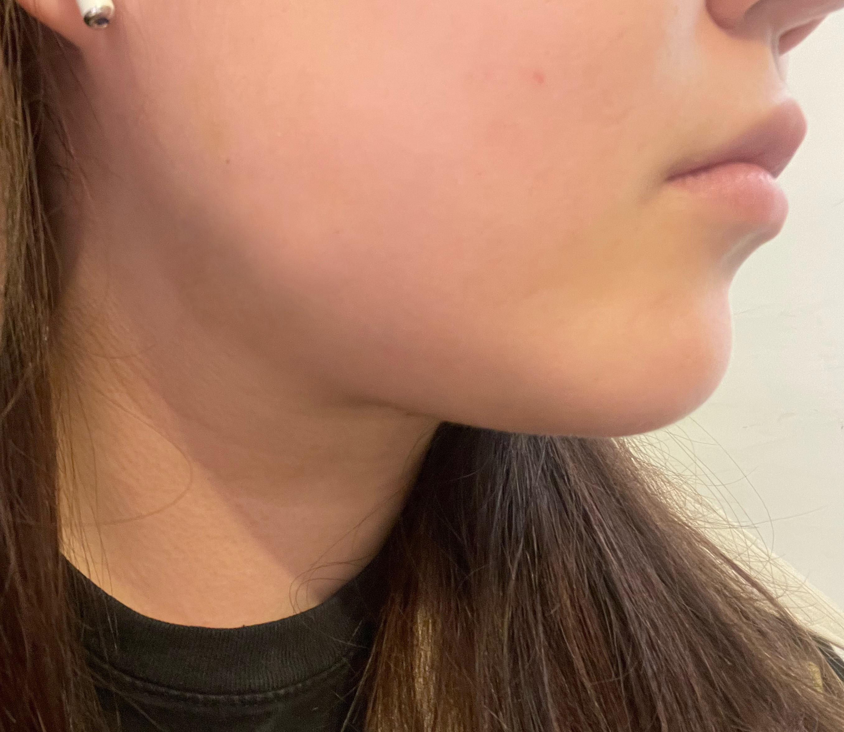 고민됐던 지방 쏙쏙 뽑았어요!!!