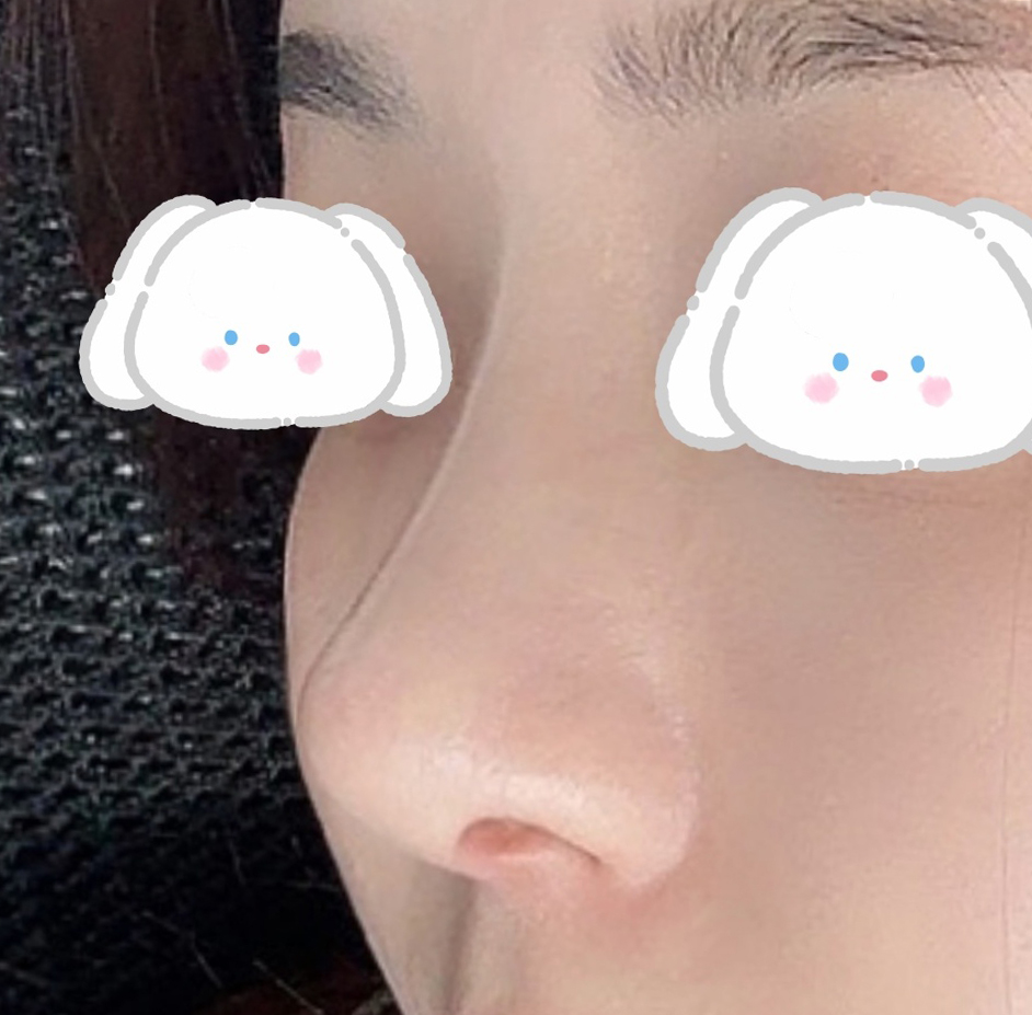 낮고 동글동글한 복코 탈출!!