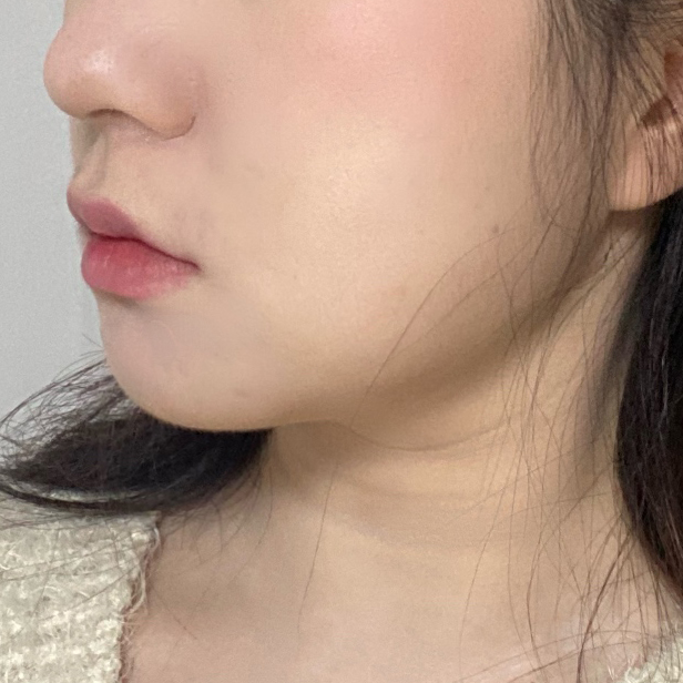 이중턱 진짜 대박임!!!!