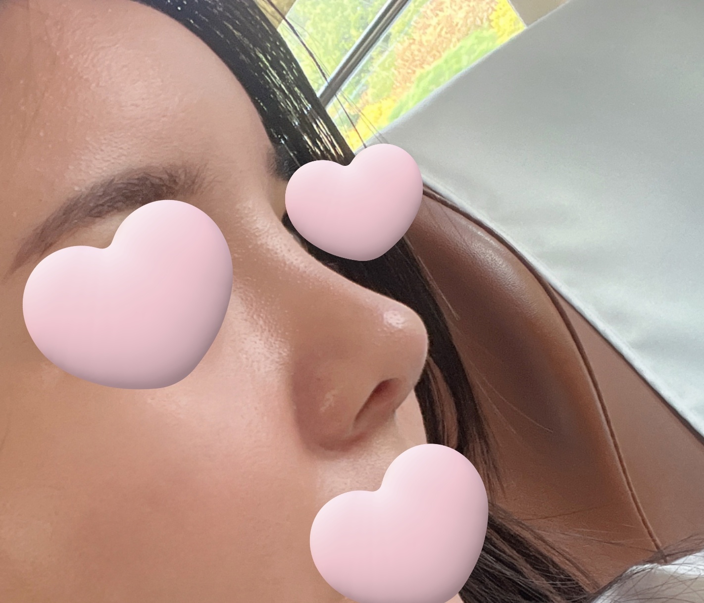 복코교정 잘된거같아요!!