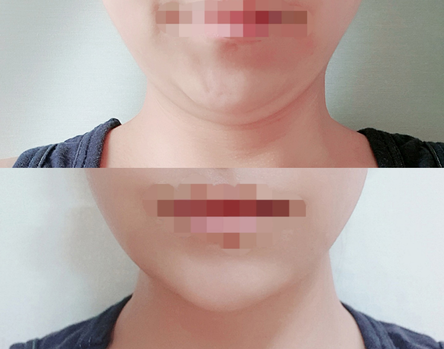 바이브 지흡 부담없고 효과 좋아용