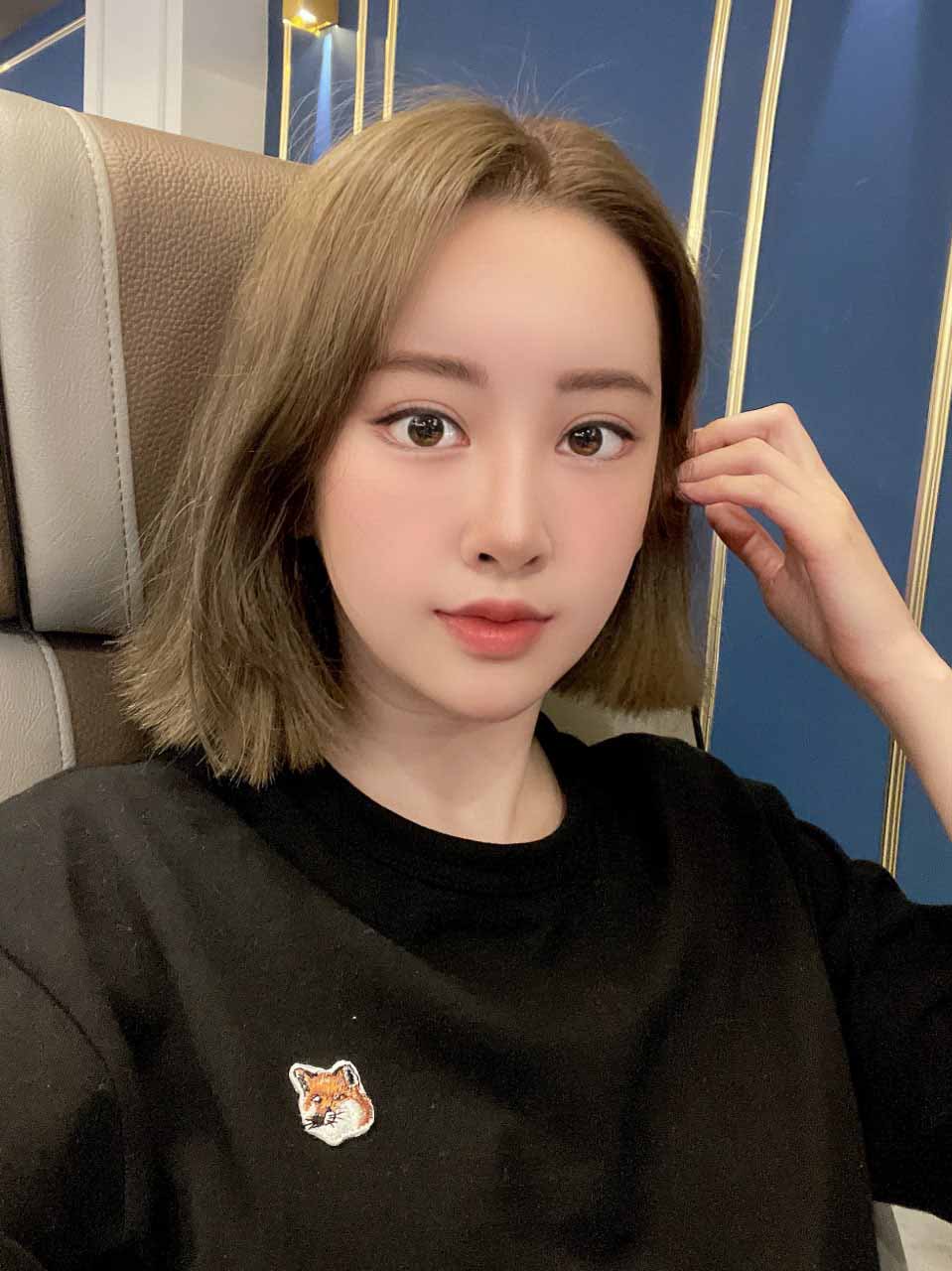 이마지방이식+코수술 조합 최고