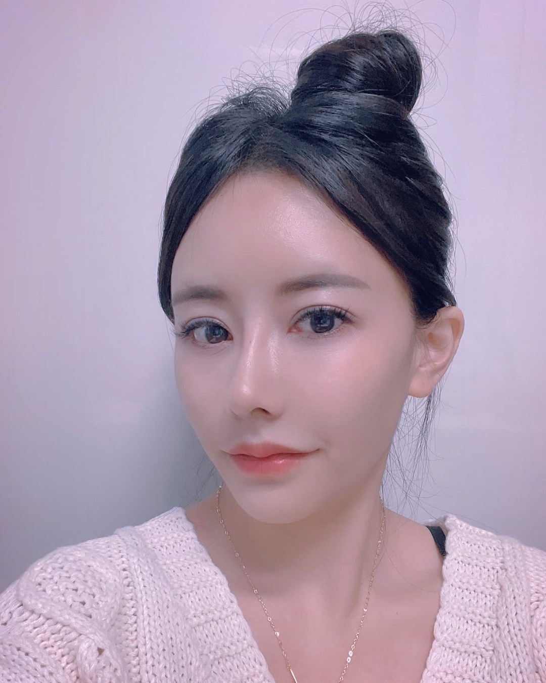 수술한지 6개월차입니다 ㅎㅎ