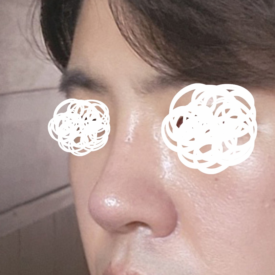 기능코+미용코 6개월차 됐습니다:)