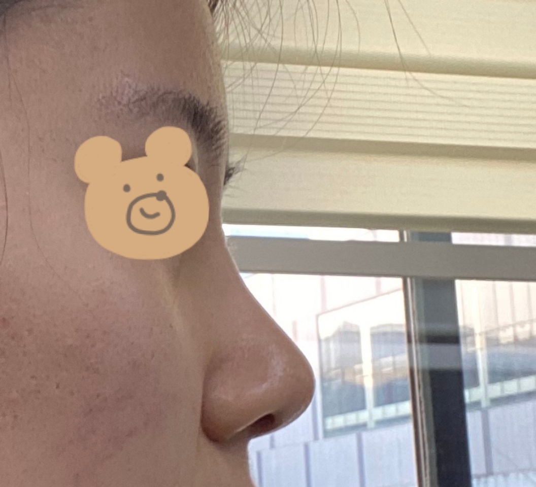 자연스러우면서 예쁜 코로 만들어 주셨어요:)