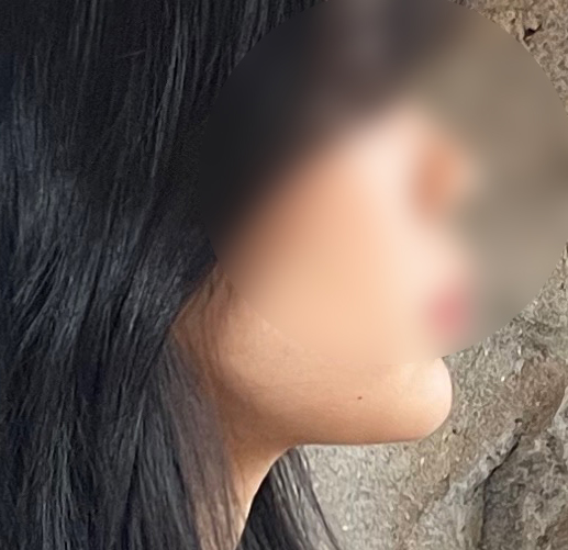 유영문원장님한테 얼지흡 받길 잘했어요:)