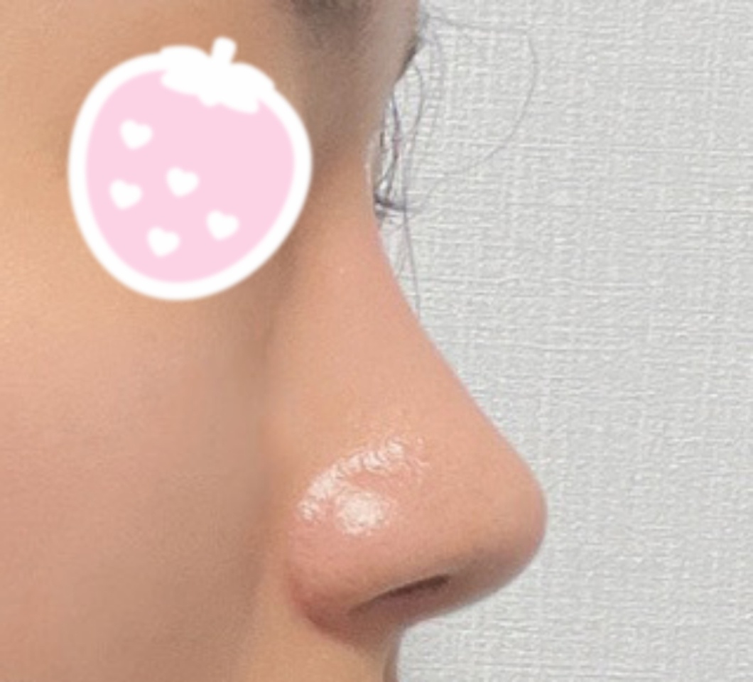 복코개선돼서 만족중~~!