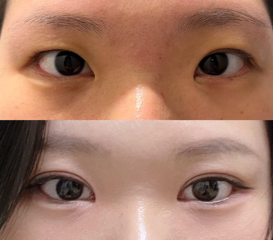 이제 쌍액, 쌍테 안써요ㅠㅠ넘좋음