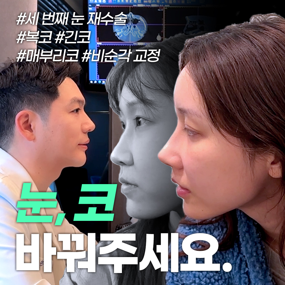 흐리멍텅에서 블랙핑크,,? 이게 되네? 중요한건 꺾이지 않는 콧대+코끝과 풀리지 않는 눈 l 눈재수술, 직반코성형 후기