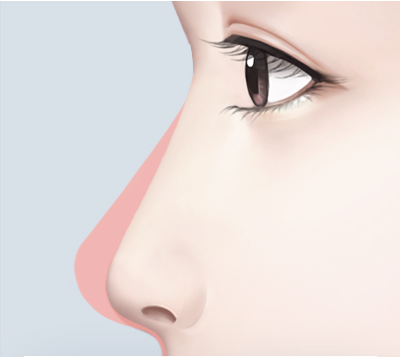 짧아지거나 뭉툭한 코끝