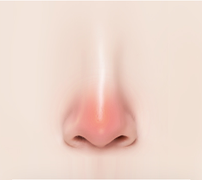 보형물이 삐뚤어진 경우